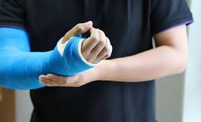 تصویر 1 از قیمت باند گچی با کیفیت بالا + خرید عمده